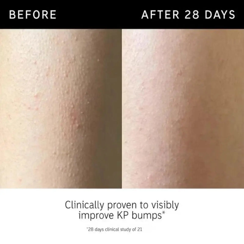 Glycolic Acid Exfoliating Body Stick