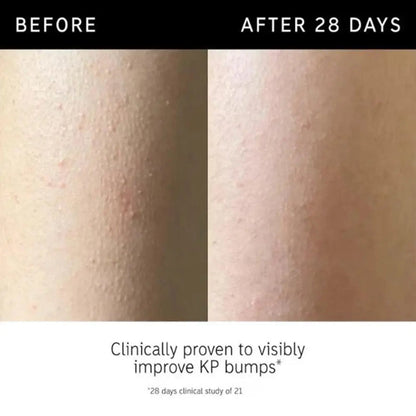 Glycolic Acid Exfoliating Body Stick